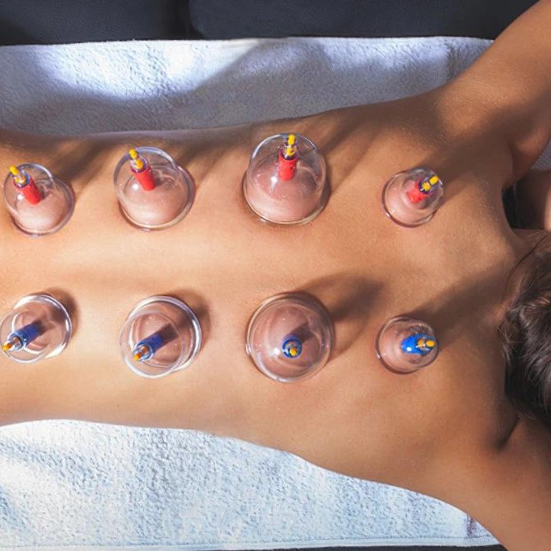 Non-invasive acupressure