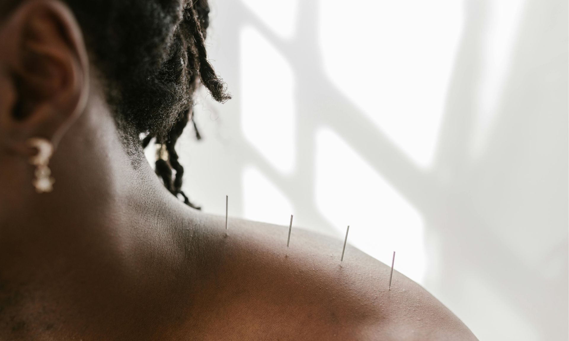 Natural healing techniques